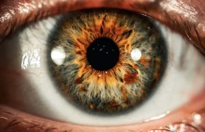 Cataract surgery and dementia are correlated.